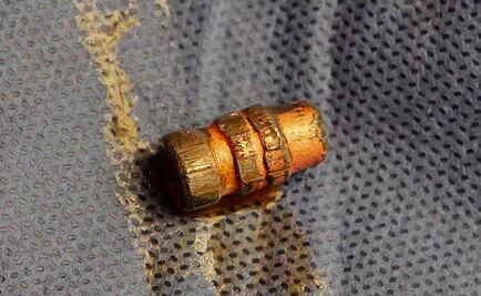 Balean a pasajera durante asalto a transporte público en Coyoacán