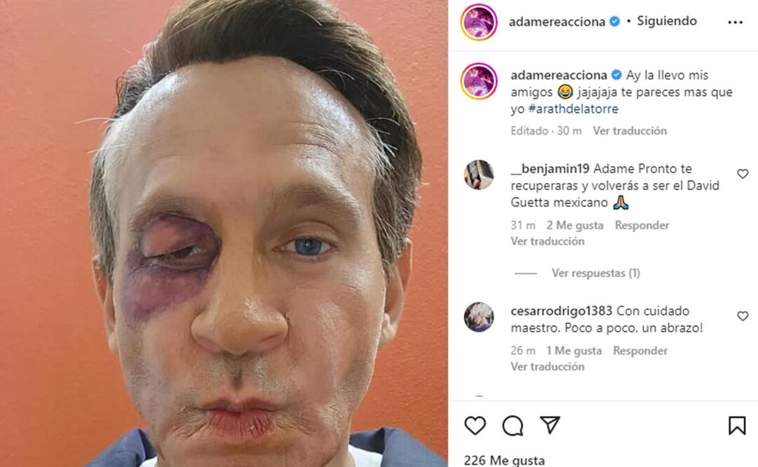 "Te pareces más que yo", le dice Alfredo Adame a Arath de la Torre por parodia