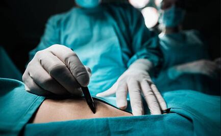 Conmociona a Bolivia caso de médico que extirpó riñón sano a niño