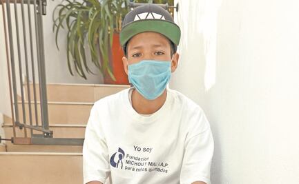 Ángel prefiere vivir sin la prótesis que le obsequiaron