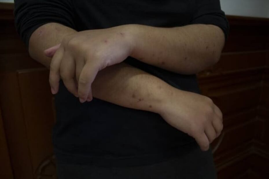 Un año de Okupa en la CNDH: "Estamos luchando por las mujeres"