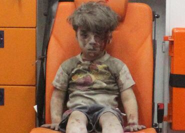 Niño pide a Obama que le ayude a llevar a menor sirio herido a su casa