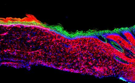 ¿Los órganos se podrían regenerar sin un transplante? 