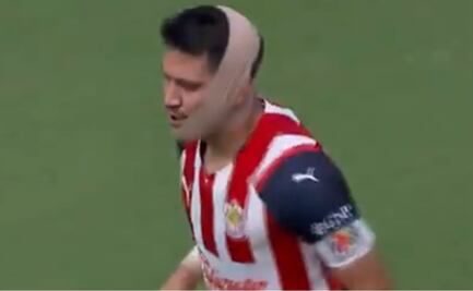 Jesús Molina se abre la barbilla en el Clásico América contra Chivas