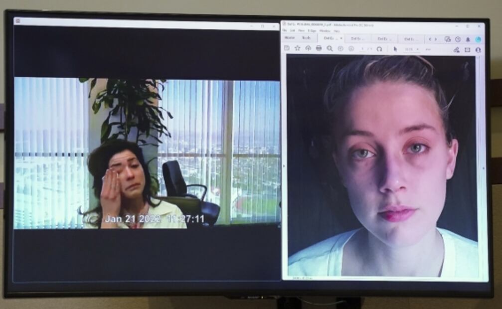 Muestran fotos de Heard golpeada; amiga de la actriz asegura que Depp es el culpable