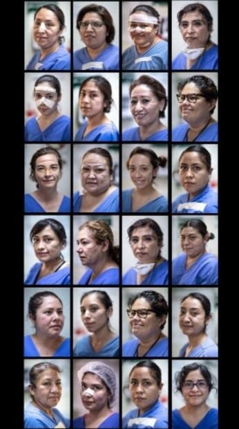Photos show the bruised faces of Mexican female healthcare workers on the frontlines of coronavirus