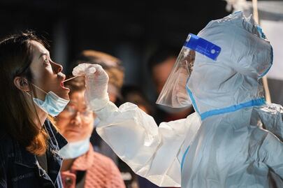 El Covid-19 podría desencadenar el síndrome de Guillain-Barré, luego de la recuperación 