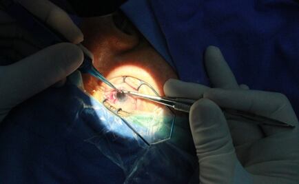 Vuelven a ver gracias a donación de córneas