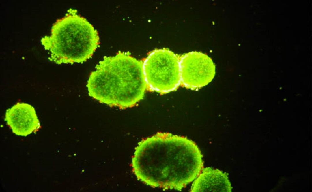 La hepatitis C es una enfermedad del hígado causada por el virus del mismo nombre, que puede originar una infección tanto aguda como crónica. FOTO: Archivo/ EL UNIVERSAL