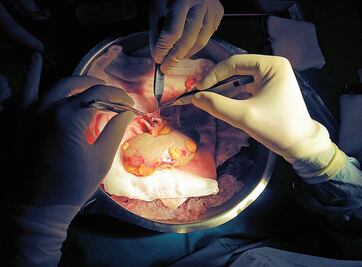 Reviven flujo sanguíneo de cerdos muertos: La técnica que mejoraría el trasplante de órganos