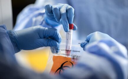 Mexico to purchase 700,000 COVID-19 test kits ahead of winter