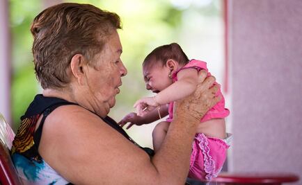 Puerto Rico detecta primer caso de microcefalia severa por zika