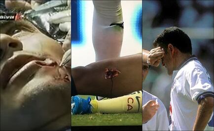 Las 5 faltas más escalofriantes en el futbol mexicano