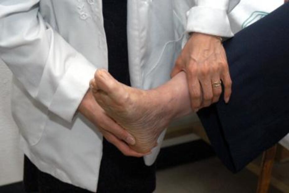 Urge IMSS a población atenderse y tratar trombosis