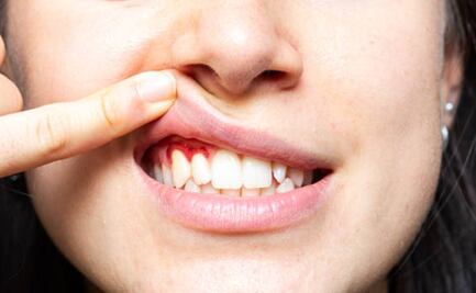 ¿Nicotina en bolsas para las encías? Esto es lo que se sabe y advierte la Secretaría de Salud