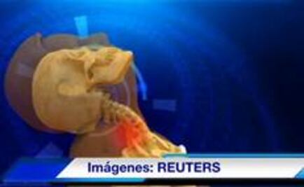 El efecto de la patada voladora que recibió el Hijo del Perro Aguayo