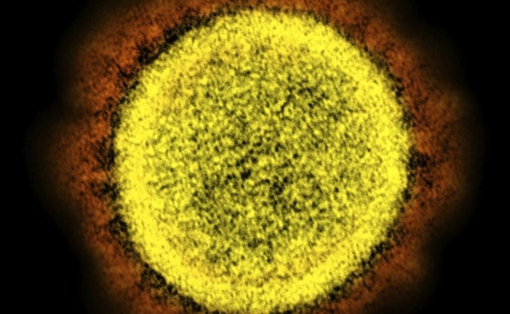 El coronavirus puede invadir y duplicarse en el cerebro: estudio