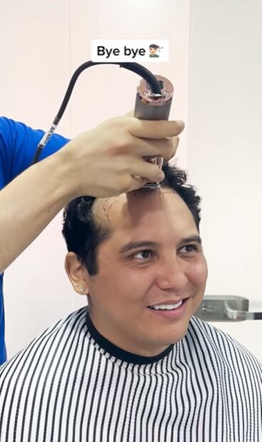 Edwin Luna, vocalista de La Trakalosa de Monterrey se sometió a un tratamiento estético 