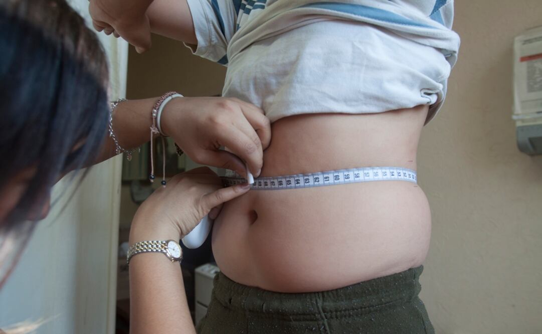 El estudio muestra que el aumento de peso incrementa el riesgo de diabetes, mientras que la enfermedad cardiovascular depende más de la genética de las personas. (FOTO:Archivo/EL UNIVERSAL)