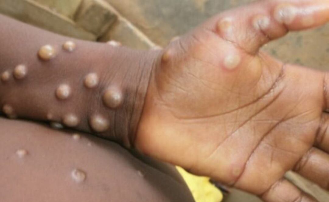 Foto: Archivo/EL UNIVERSAL