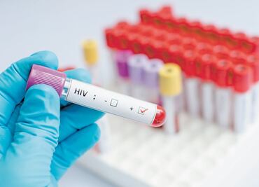 Revelan que tratamiento con proteínas sintéticas conduciría a la cura del VIH: estudio