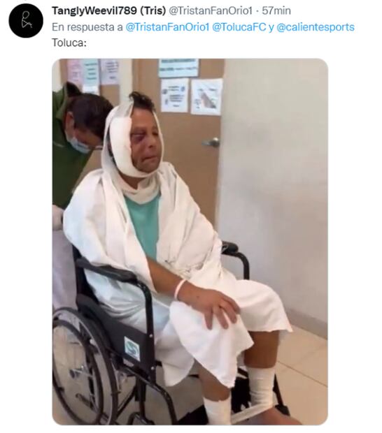 Los mejores memes que dejó la final donde Pachuca goleó al Toluca