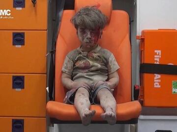 Imagen de niño herido en Alepo se vuelve viral