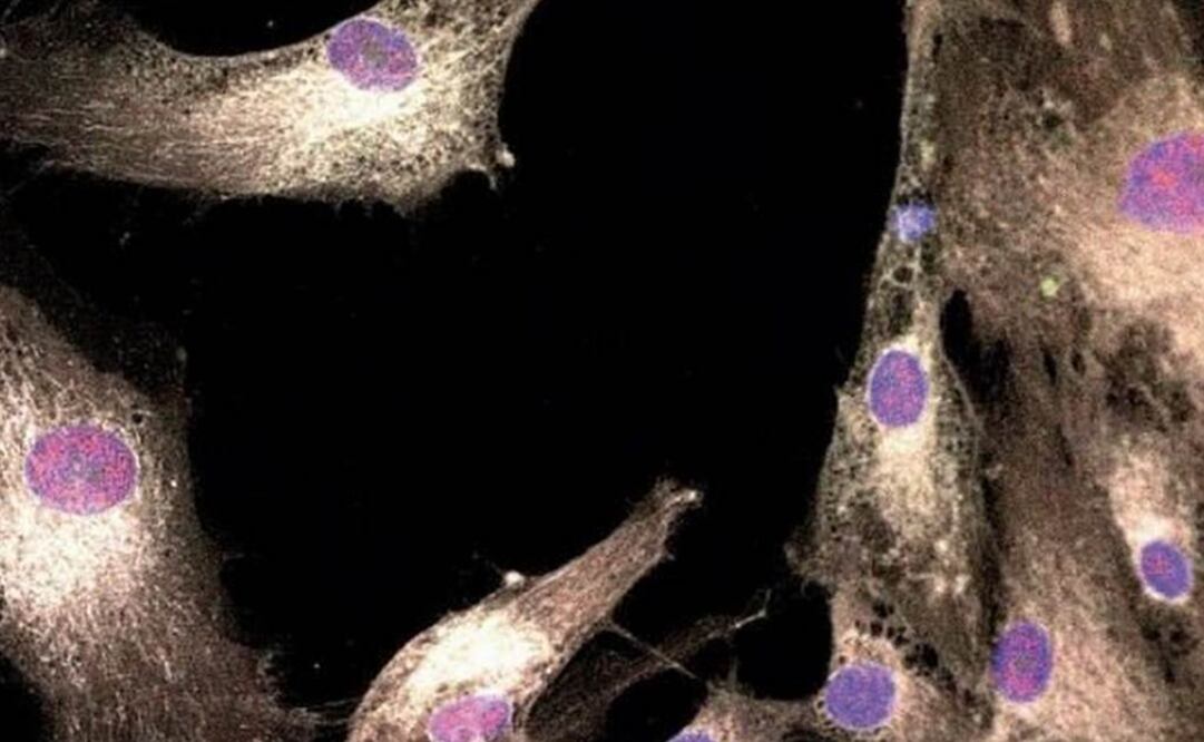 Imagen del músculo liso regenerado a partir de células madre de la pulpa dental. FOTO: UIC