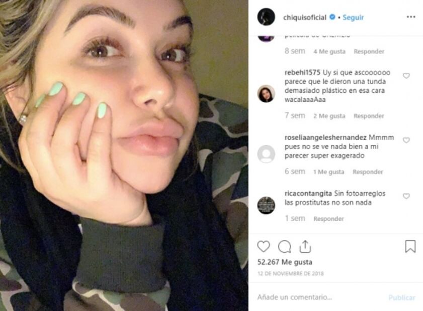 ¿Qué pasa con los labios de Chiquis Rivera? 