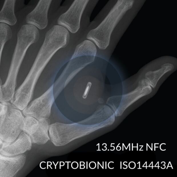 La biohacker que quiere ser cyborg y se implantó más de 50 chips