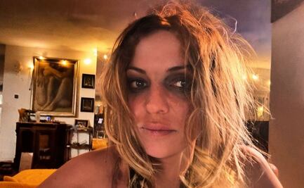 Hijo de Camilo Sesto publica foto en muy malas condiciones y responde a quienes le piden que ¡deje las drogas!