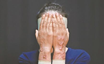 ¿Cómo se clasifican los ataques con ácido en México?