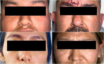 Caen cuatro personas ligadas al Cártel de Sinaloa en Xochimilco; les decomisan armas y drogas