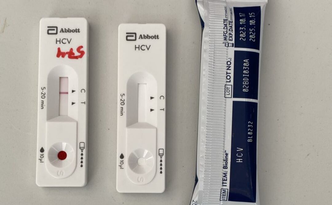 En los Centros de Salud de la CDMX se realizan pruebas gratuitas a personas mayores de 18 años. Foto Especial