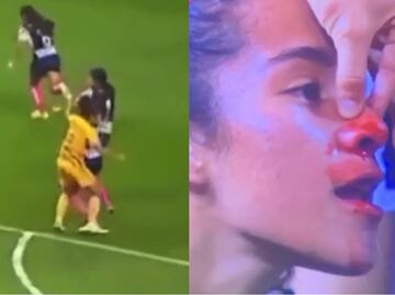 VIDEO: Stephany Mayor golpea y sangra a jugadora de Rayadas; no la expulsaron