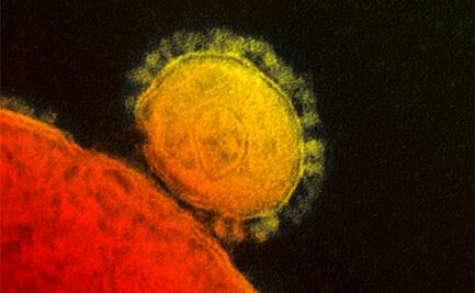 Anticuerpos del SARS de 2003 neutralizan limitadamente al Covid-19: estudio