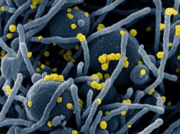 Covid-19: El papel de los anticuerpos IgA para neutralizar el coronavirus