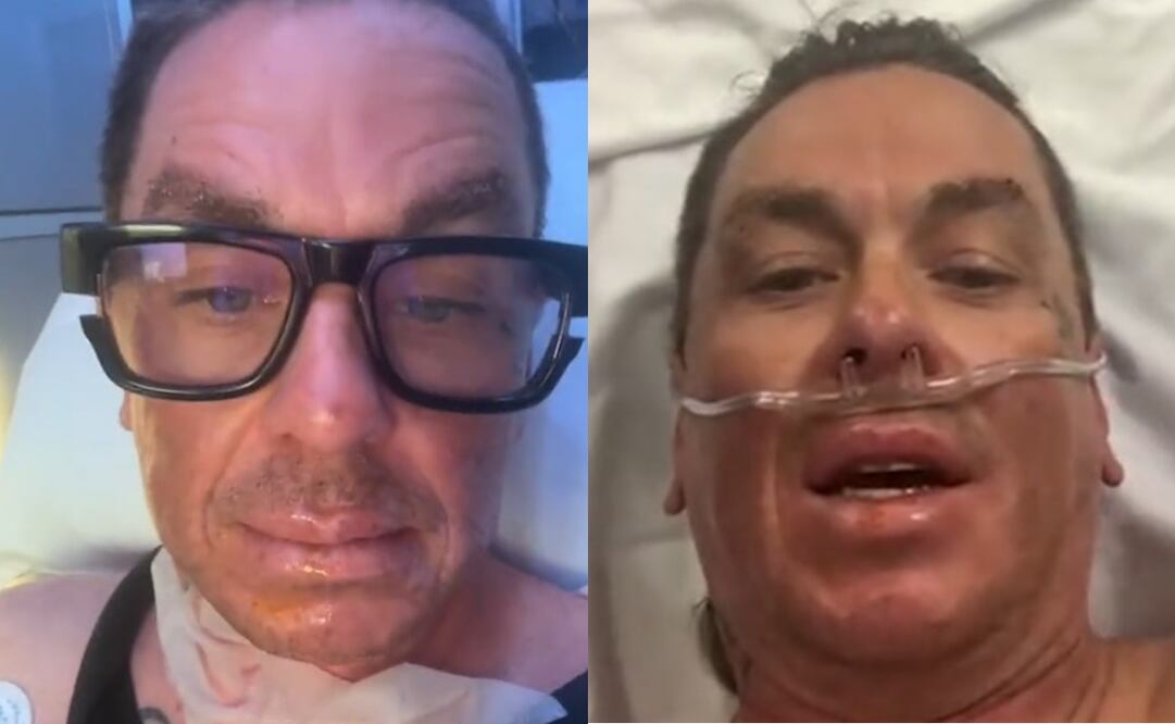 Sid Wilson, compartió el desafortunado accidente en redes sociales. Captura vía Instagram.