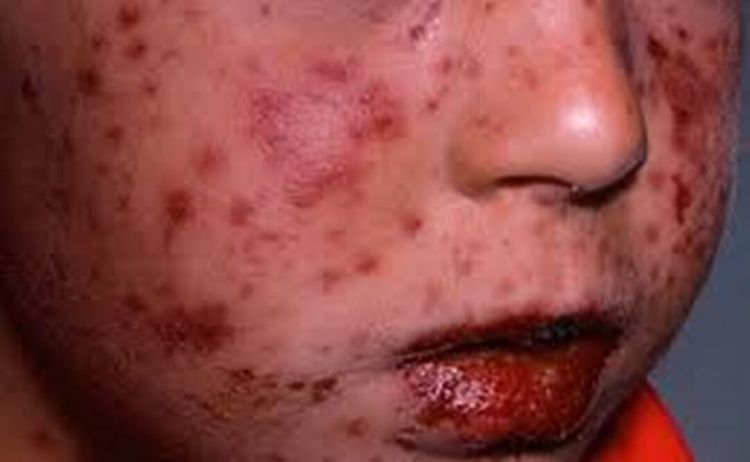 Foto: Archivo/ EL UNIVERSAL