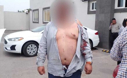 Dan golpiza a policías de investigación al confundirlos con criminales en Edomex