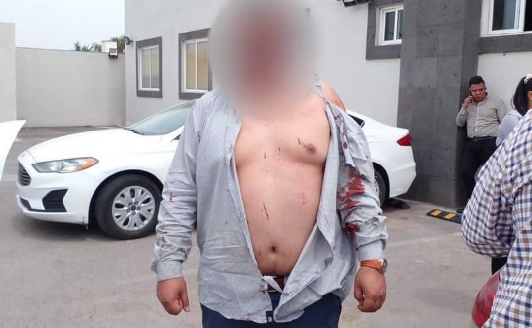 Un grupo de aproximadamente 20 personas del sexo masculino agredieron físicamente a los agentes ocasionándoles diferentes lesiones. Foto: Especial