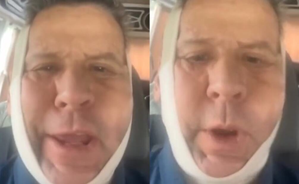 El actor Alfredo Adame subió un video a redes sociales con el rostro visiblemente hinchado. Captura vía Tiktok @
tendenciaspopmx.