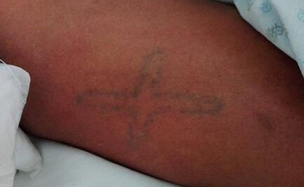 Piden apoyo para identificar a paciente de Hospital de Zumpango 