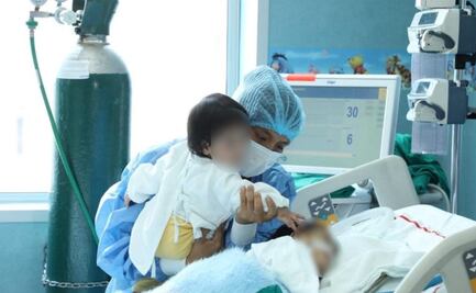 Siameses unidos por el vientre son operados con éxito en Perú