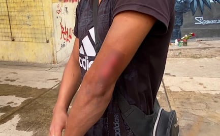 "Fue una tragedia, había mucha gente quemada”; Eduardo asegura que un milagro lo salvó de morir en explosión en Iztapalapa