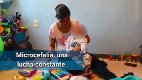 Les dijeron que Edson nacería muerto; lleva 2 años luchando con la microcefalia