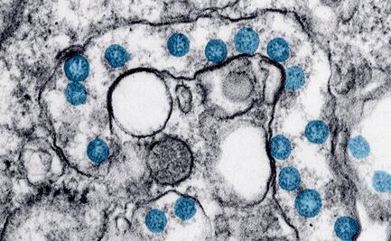 Células madre reducen daños y riesgo de muerte por Covid-19: estudio