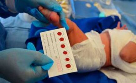 ¿En qué consiste la Prueba del Tamiz Neonatal?