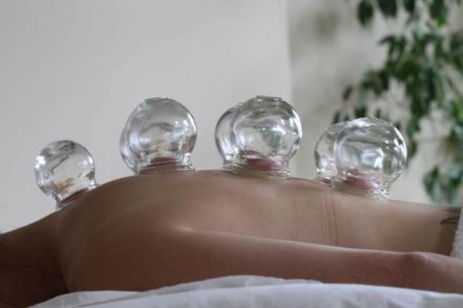 El "cupping" de Michael Phelps, medicina recomendada por el profeta Mahoma