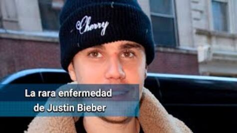 Justin Bieber padece "Lyme"